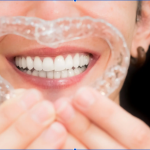 Why Do Some Tooth Gaps Respond Better to Invisalign Than Others? Invisalign gap teeth