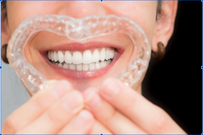 Invisalign gap teeth